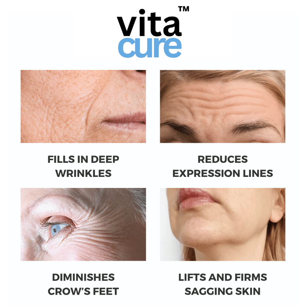 Vitacure™ – Anti-Wrinkle Freeze-Dried Nano-Silk Collagen System