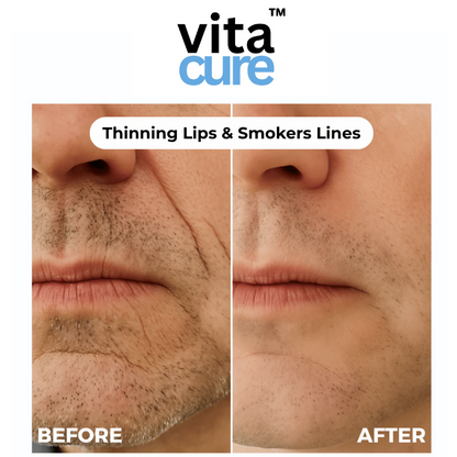 Vitacure™  – Anti-Wrinkle Freeze-Dried Nano-Silk Collagen System